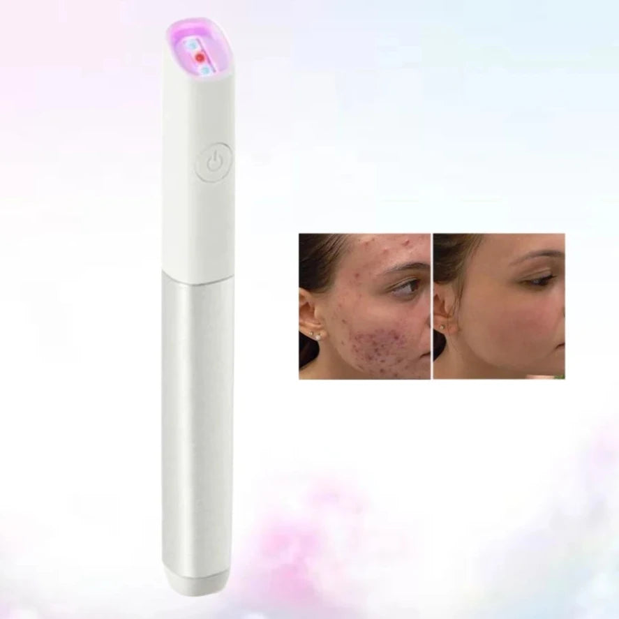 Acne Vanish Pro™ | Licht Therapie Pen